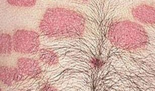 A variety of pink formations in the stomach
