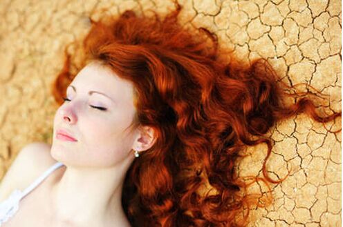 Girl with psoriasis