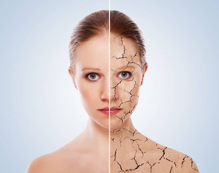 Healthy skin and skin affected by psoriasis